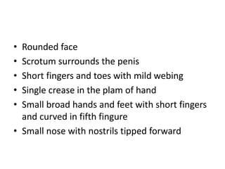 • Rounded face
• Scrotum surrounds the penis
• Short fingers and toes with mild webing
• Single crease in the plam of hand
• Small broad hands and feet with short fingers
and curved in fifth fingure
• Small nose with nostrils tipped forward
 
