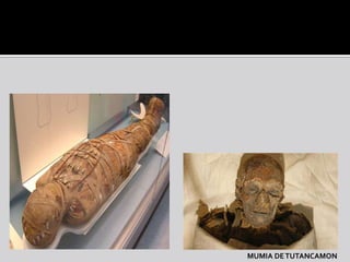 MUMIA DE TUTANCAMON
 