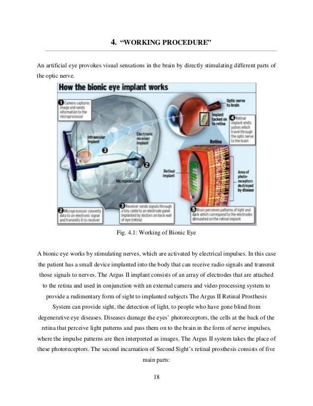 aartificial eye seminar full report eye works rapid city