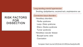 RISK FACTORS
FOR
DISSECTION
European Heart Journal (2014):doi:10.1093/eurheartj/ehu281
 