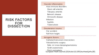 RISK FACTORS
FOR
DISSECTION
European Heart Journal (2014):doi:10.1093/eurheartj/ehu281
 