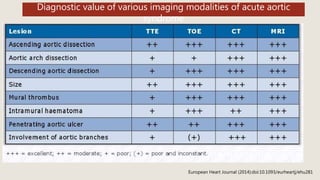 Diagnostic value of various imaging modalities of acute aortic
syndrome
European Heart Journal (2014):doi:10.1093/eurheartj/ehu281
 
