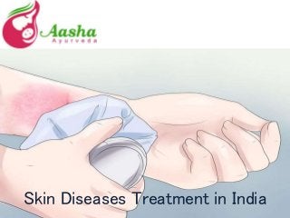 Skin Diseases Treatment in India
 
