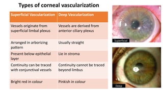 Aborizing Pattern PHYSIOLOGY OF CORNEA DETAILS | PPTX