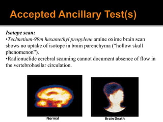Normal Brain Death
Isotope scan:
•Technetium-99m hexamethyl propylene amine oxime brain scan
shows no uptake of isotope in brain parenchyma (“hollow skull
phenomenon”).
•Radionuclide cerebral scanning cannot document absence of flow in
the vertebrobasilar circulation.
 