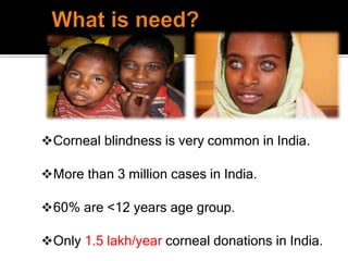 Corneal blindness is very common in India.
More than 3 million cases in India.
60% are <12 years age group.
Only 1.5 lakh/year corneal donations in India.
 