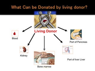 Kidney
Blood
BoneL
m
un
ag
rr
sow
Part of liver Liver
Part of Pancreas
Living Donor
 