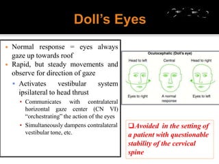 ◾ Normal response = eyes always
gaze up towards roof
◾ Rapid, but steady movements and
observe for direction of gaze
 Activates vestibular system
ipsilateral to head thrust
horizontal gaze
▪ Communicates with contralateral
center (CN VI)
“orchestrating” the action of the eyes
▪ Simultaneously dampens contralateral
vestibular tone, etc.
Avoided in the setting of
a patient with questionable
stability of the cervical
spine
 