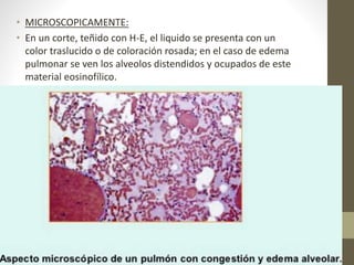 • MICROSCOPICAMENTE:
• En un corte, teñido con H-E, el liquido se presenta con un
color traslucido o de coloración rosada; en el caso de edema
pulmonar se ven los alveolos distendidos y ocupados de este
material eosinofílico.
 
