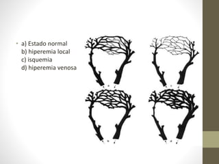 • a) Estado normal
b) hiperemia local
c) isquemia
d) hiperemia venosa
 