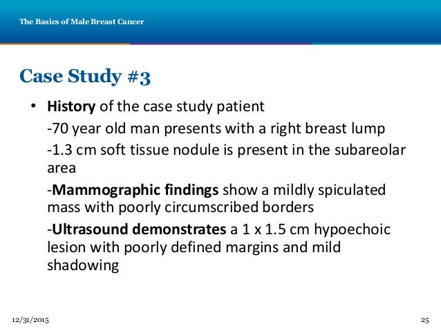 male breast cancer case study