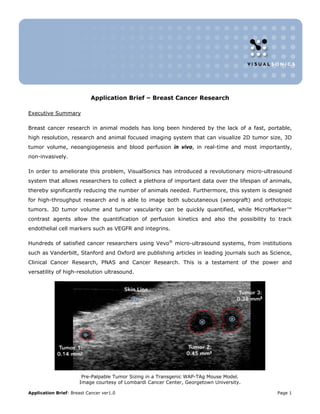 Application Brief – Breast Cancer Research

Executive Summary

Breast cancer research in animal models has long been hindered by the lack of a fast, portable,
high resolution, research and animal focused imaging system that can visualize 2D tumor size, 3D
tumor volume, neoangiogenesis and blood perfusion in vivo, in real-time and most importantly,
non-invasively.

In order to ameliorate this problem, VisualSonics has introduced a revolutionary micro-ultrasound
system that allows researchers to collect a plethora of important data over the lifespan of animals,
thereby significantly reducing the number of animals needed. Furthermore, this system is designed
for high-throughput research and is able to image both subcutaneous (xenograft) and orthotopic
tumors. 3D tumor volume and tumor vascularity can be quickly quantified, while MicroMarker™
contrast agents allow the quantification of perfusion kinetics and also the possibility to track
endothelial cell markers such as VEGFR and integrins.

Hundreds of satisfied cancer researchers using Vevo® micro-ultrasound systems, from institutions
such as Vanderbilt, Stanford and Oxford are publishing articles in leading journals such as Science,
Clinical Cancer Research, PNAS and Cancer Research. This is a testament of the power and
versatility of high-resolution ultrasound.




                       Pre-Palpable Tumor Sizing in a Transgenic WAP-TAg Mouse Model.
                      Image courtesy of Lombardi Cancer Center, Georgetown University.

Application Brief: Breast Cancer ver1.0                                                       Page 1
 