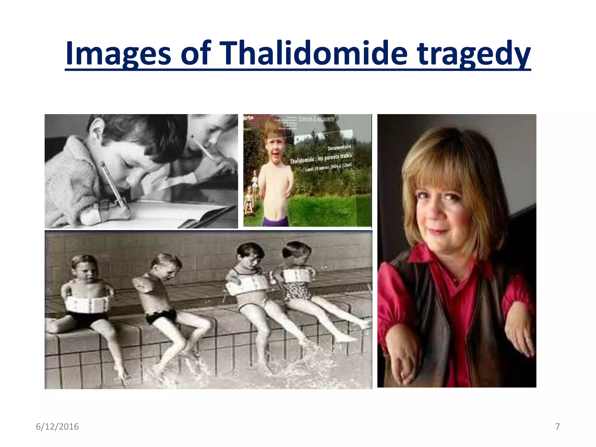 Images of Thalidomide tragedy
6/12/2016 7
 