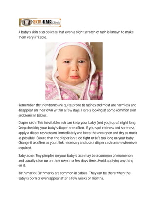 A baby's skin is so delicate that even a slight scratch or rash is known to make
them very irritable.
Remember that newborns are quite prone to rashes and most are harmless and
disappear on their own within a few days. Here's looking at some common skin
problems in babies:
Diaper rash: This inevitable rash can keep your baby (and you) up all night long.
Keep checking your baby's diaper area often. If you spot redness and soreness,
apply a diaper rash cream immediately and keep the area open and dry as much
as possible. Ensure that the diaper isn't too tight or left too long on your baby.
Change it as often as you think necessary and use a diaper rash cream whenever
required.
Baby acne: Tiny pimples on your baby's face may be a common phenomenon
and usually clear up on their own in a few days time. Avoid applying anything
on it.
Birth marks: Birthmarks are common in babies. They can be there when the
baby is born or even appear after a few weeks or months.
 
