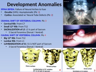Anatomy of the back part 1– Vertebrae.pptx