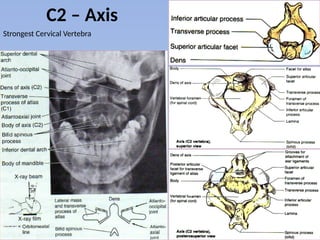 C2 Back Anatomy of the back part 1– Vertebrae.pptx