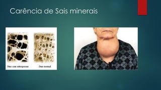 Carência de Sais minerais
 