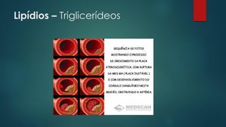 Lipídios – Triglicerídeos
 