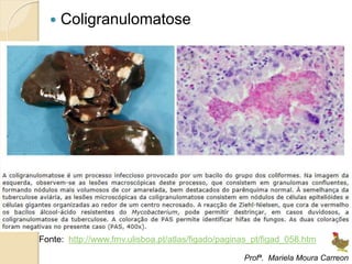  Coligranulomatose
Profª. Mariela Moura Carreon
Fonte: http://www.fmv.ulisboa.pt/atlas/figado/paginas_pt/figad_058.htm
 
