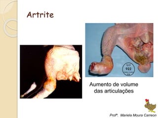 Artrite
Aumento de volume
das articulações
Profª. Mariela Moura Carreon
 