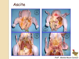 Ascite
Profª. Mariela Moura Carreon
 