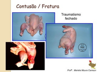 Traumatismo
fechado
Contusão / Fratura
Profª. Mariela Moura Carreon
 