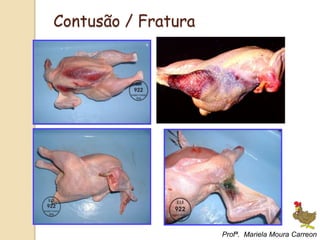 Contusão / Fratura
Profª. Mariela Moura Carreon
 