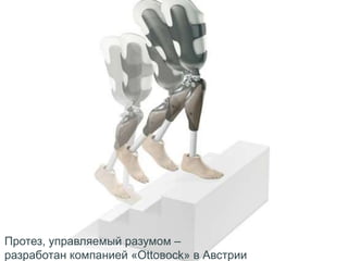 Протез, управляемый разумом –
разработан компанией «Ottoвock» в Австрии
 