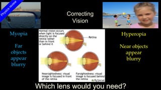 Myopia
Far
objects
appear
blurry
Hyperopia
Near objects
appear
blurry
Which lens would you need?
Correcting
Vision
Physics
review
 