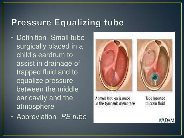 Abbreviations of the eye and ear chapter 13