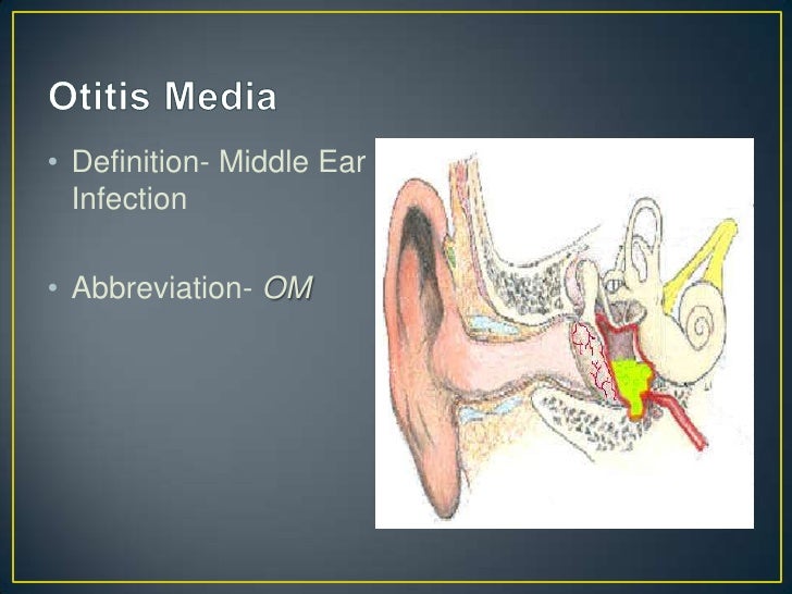 Abbreviations of the eye and ear chapter 13