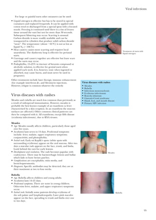 For large or painful warts other measures can be used:
• Liquid nitrogen is effective but has to be stored in special
containers and replaced frequently. It can be applied with
cotton wool or discharged from a special spray with a focused
nozzle. Freezing is continued until there is a rim of frozen
tissue around the wart but not for more than 30 seconds.
Subsequent blistering may occur. Scarring is unusual.
Carbon dioxide is more readily available and can be
transported in cylinders that produce solid carbon dioxide
“snow”. The temperature (about Ϫ64 ЊC) is not as low as
liquid N2 (Ϫ196 ЊC)
• Heat cautery causes more scarring and requires local
anaesthesia. The diathermy loop is effective for perianal
warts.
• Curettage and cautery together are effective but leave scars
and the warts may recur.
• Podophyllin, 15–25% in tincture of benzoin compound or
alcoholic solution, is effective for genital warts when
applied each week. It is, however, toxic when ingested or
absorbed, may cause burns, and must never be used in
pregnancy.
Other treatments include laser therapy, immune enhancement
(for example interferon ␤), and bleomycin injections.
However, relapse is common whatever the remedy.
Virus diseases with rashes
Measles and rubella are much less common than previously as
a result of widespread immunisation. However, measles is
probably the best known example of an exanthem (a fever
characterised by a skin eruption. In an enanthem the mucous
surfaces are affected.) Other common clinical patterns can
then be compared with it. All exanthems, except fifth disease
(erythema infectiosum), due to RNA viruses.
Measles
• Age. Measles usually affects children, particularly those aged
over five years.
• Incubation lasts seven to 14 days. Prodromal symptoms
include: fever, malaise, upper respiratory symptoms;
conjunctivitis; and photophobia.
• Initial rash. Early on Koplik’s spots (white spots with
surrounding erythema) appear on the oral mucosa. After two
days a macular rash appears on the face, trunk, and limbs.
Look behind the ears for early lesions.
• Development and resolution. The rash becomes papular, with
coalescence. There may be haemorrhagic lesions and bullae
which fade to leave brown patches.
• Complications are encephalitis, otitis media, and
bronchopneumonia.
• Diagnosis. Specific antibodies may be detected; they are at
their maximum at two to four weeks.
Rubella
• Age. Rubella affects children and young adults.
• Incubation lasts 14–21 days.
• Prodromal symptoms. There are none in young children.
Otherwise fever, malaise, and upper respiratory symptoms
occur.
• Initial rash. Initially some patients develop erythema of
the soft palate and lymphadenopathy. Later pink macules
appear on the face, spreading to trunk and limbs over one
to two days.
Viral infections
95
Virus diseases with rashes
• Measles
• Rubella
• Infectious mononucleosis
• Erythema infectiosum
• Roseola infantum
• Gianotti–Crosti syndrome
• Hand, foot, and mouth disease
• Primary HIV infection
Treatment of warts with
liquid nitrogen
Measles
Rubella
 
