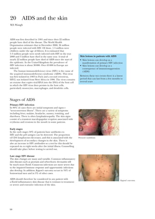 Skin lesions in patients with AIDS
• Skin lesions can develop as a
manifestation of primary HIV infection
• Skin lesions can develop as a
consequence of immunosuppression
(AIDS)
Between these two events there is a latent
period that can last from a few months to
several years
98
AIDS was first described in 1981 and since then 22 million
people have died of the disease. The World Health
Organisation estimates that in December 2000, 36 million
people were infected with HIV. Of these, 1·5 million were
children under the age of fifteen. It is estimated that
5·3 million people were newly infected with HIV in the year
2000 and 3 million have died in the same year. A total of
nearly 22 million people have died of AIDS since the start of
the epidemic. In the United Kingdom the prevalence of
HIV infection is about 30000. Over 65000 in Europe are
infected.
The human immunodeficiency virus (HIV) is the cause of
the acquired immunodeficiency syndrome (AIDS). This virus
was first isolated in 1983 in Paris and a second retrovirus,
HIV2, was isolated from West Africa in 1986. The virus contains
an enzyme that copies viral RNA into the DNA of the host cell
in which the HIV virus then persists in the host cells,
particularly monocytes, macrophages, and dendritic cells.
Stages of AIDS
Primary HIV infection
In 80% of cases there are initial symptoms and signs—
“seroconversion illness”. There are a variety of symptoms
including fever, malaise, headache, nausea, vomiting, and
diarrhoea. There is often lymphadenopathy. The skin signs
consist of a transient maculopapular eruption associated with
erythema and erosions in the mouth in some patients.
Early stages
In the early stages 50% of patients have antibiotics to
HIV and the p24 antigen can be detected. The proportion
of CD4 lymphocytes decreases, and this is associated with the
development of secondary changes in the skin. There is
also an increase in HIV antibodies so a test for this should be
repeated six to eight weeks after the initial illness. Counselling
should take place before testing is carried out.
Late stage HIV disease
The skin changes are many and variable. Common inflammatory
skin diseases such as psoriasis and seborrhoeic dermatitis will
be much more florid. Cutaneous infections are more severe due
to the impaired immune response and opportunistic infections
also develop. In addition, Kaposi’s sarcoma occurs in 34% of
homosexual men and in 5% of other cases.
AIDS should therefore be considered in any patient with
a florid inflammatory skin disease that is resistant to treatment
or severe and extensive infection of the skin.
20 AIDS and the skin
MA Waugh
Flexural candidiasis
Kaposi’s sarcoma
 