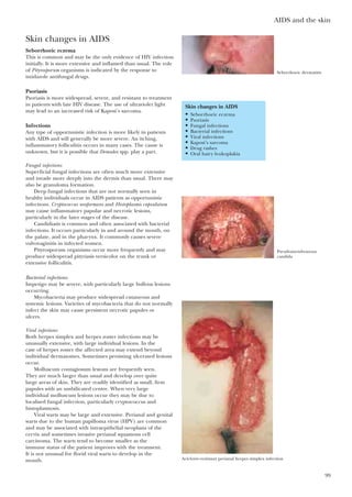 AIDS and the skin
99
Skin changes in AIDS
Seborrhoeic eczema
This is common and may be the only evidence of HIV infection
initially. It is more extensive and inflamed than usual. The role
of Pityrosporum organisms is indicated by the response to
imidazole antifungal drugs.
Psoriasis
Psoriasis is more widespread, severe, and resistant to treatment
in patients with late HIV disease. The use of ultraviolet light
may lead to an increased risk of Kaposi’s sarcoma.
Infections
Any type of opportunistic infection is more likely in patients
with AIDS and will generally be more severe. An itching,
inflammatory folliculitis occurs in many cases. The cause is
unknown, but it is possible that Demodex spp. play a part.
Fungal infections
Superficial fungal infections are often much more extensive
and invade more deeply into the dermis than usual. There may
also be granuloma formation.
Deep fungal infections that are not normally seen in
healthy individuals occur in AIDS patients as opportunistic
infections. Cryptococcus neoformans and Histoplasma capsulatum
may cause inflammatory papular and necrotic lesions,
particularly in the later stages of the disease.
Candidiasis is common and often associated with bacterial
infections. It occurs particularly in and around the mouth, on
the palate, and in the pharynx. It commonly causes severe
vulvovaginitis in infected women.
Pityrosporum organisms occur more frequently and may
produce widespread pityriasis versicolor on the trunk or
extensive folliculitis.
Bacterial infections
Impetigo may be severe, with particularly large bullous lesions
occurring.
Mycobacteria may produce widespread cutaneous and
systemic lesions. Varieties of mycobacteria that do not normally
infect the skin may cause persistent necrotic papules or
ulcers.
Viral infections
Both herpes simplex and herpes zoster infections may be
unusually extensive, with large individual lesions. In the
case of herpes zoster the affected area may extend beyond
individual dermatomes. Sometimes persisting ulcerated lesions
occur.
Molluscum contagiosum lesions are frequently seen.
They are much larger than usual and develop over quite
large areas of skin. They are readily identified as small, firm
papules with an umbilicated centre. When very large
individual molluscum lesions occur they may be due to
localised fungal infection, particularly cryptococcus and
histoplasmosis.
Viral warts may be large and extensive. Perianal and genital
warts due to the human papilloma virus (HPV) are common
and may be associated with intraepithelial neoplasia of the
cervix and sometimes invasive perianal squamous cell
carcinoma. The warts tend to become smaller as the
immune status of the patient improves with the treatment.
It is not unusual for florid viral warts to develop in the
mouth.
Skin changes in AIDS
• Seborrhoeic eczema
• Psoriasis
• Fungal infections
• Bacterial infections
• Viral infections
• Kaposi’s sarcoma
• Drug rashes
• Oral hairy leukoplakia
Seborrhoeic dermatitis
Pseudomembranous
candida
Aciclovir–resistant perianal herpes simplex infection
 