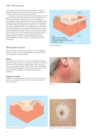 can develop widespread metastases. Recognition of typical
benign tumours saves the patient unneccessary investigations
and the anxiety involved in waiting for results.
Although a wide range of internal diseases produce physical
signs in the skin, most skin diseases do not themselves have
serious physical effects. However there can be significant
psychological effects and problems with personal relationships,
employment, and sporting activity. It is therefore important to
use what Dr Papworth called “wide angle lenses” in assessing
the patient and their disease. So, in addition to concentrating
on the skin changes, the overall health and demeanour of the
patient should be taken into account. This also means making
sure that there are no other signs, such as involvement of the
nails, mucous membranes, or other parts of the skin. The
general physical condition and psychological state of the
patient should be assessed, with more specific examination
if indicated.
Descriptive terms
All specialties have their own common terms, and familiarity
with a few of those used in dermatology is a great help. The
most important are defined below.
Macule
Derived from the Latin for a stain, the term macule is used to
describe changes in colour or consistency without any elevation
above the surface of the surrounding skin. There may be an
increase of melanin, giving a black or blue colour depending
on the depth of the pigment. Loss of melanin leads to a white
macule. Vascular dilatation and inflammation produce
erythema.
Papules and nodules
A papule is a circumscribed, raised lesion, conventionally less
than 1cm in diameter. It may be due to either epidermal or
dermal changes.
ABC of Dermatology
2
Epidermis
a
b
c
d
DermisMacule
a) Melanin pigment in epidermis
b) Melanin pigment below epidermis
c) Erythema due to dilated dermal blood vessels
d) Inflammation in dermis
Section through skin
Eythema
Section through skin with a papule A papule surrounded by a depigmented macule
 