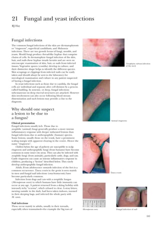 101
Fungal infections
The common fungal infections of the skin are dermatophytosis
or “ringworm”, superficial candidiasis, and Malassezia
infections. There are two growth forms of fungi, moulds, and
yeasts. Mould fungi produce thread-like hyphae that comprise
chains of cells. In dermatophyte fungal infection of the skin,
hair, and nails these hyphae invade keratin and are seen on
microscopic examination of skin, hair, or nails from infected
tissues. Vegetative spores (conidia) develop in culture, and
their distinctive shape helps to identify the different species.
Skin scrapings or clippings from infected nails can be easily
taken and should always be sent to the laboratory for
mycological examination and culture in any patient suspected
of having a fungal infection.
In yeast infections such as those due to candida, the fungal
cells are individual and separate after cell division by a process
called budding. In systemic, or deep, fungal infections
subcutaneous on deep visceral structures are attacked. However
skin involvement can also occur following blood stream
dissemination and such lesions may provide a clue to the
diagnosis.
Why should one suspect
a lesion to be due to
a fungus?
Clinical presentation
Fungal infections usually itch. Those due to
zoophilic (animal) fungi generally produce a more intense
inflammatory response with deeper indurated lesions than
fungal infections due to anthropophilic (human) species.
Some lesions, usually those on the trunk, have a prominent
scaling margin with apparent clearing in the centre. Hence the
name “ringworm”.
Children below the age of puberty are susceptible to scalp
ringworm and anthropophilic fungi (from humans) have become
common in some inner city areas. They can also be infected with
zoophilic fungi (from animals), particularly cattle, dogs, and cats.
Cattle ringworm can cause an intense inflammatory response in
children, producing a “kerion” described below. They rarely
develop anthropophilic fungal infection.
Adults. From adolescence onwards infection of the feet is a
common occurrence. Tinea cruris in the groin is seen mainly
in men and fungal nail infections (onychomycosis) have
become particularly common.
Infection from dogs and cats with a zoophilic fungus
(Microsporum canis) to which humans have little immunity can
occur at any age. A patient returned from a skiing holiday with
intensely itchy “eczema”, which refused to clear. A stray kitten,
mewing outside in the dark, had been taken indoors, warmed
in their sleeping bags, and infected the whole party with
M. canis.
Nail infections
These occur mainly in adults, usually in their toenails,
especially when traumatised—for example the big toes of
21 Fungal and yeast infections
RJ Hay
Tricophyton rubrum infection
of the neck
Animal ringworm
Tinea cruris
Microsporum canis Fungal infection of nail
 