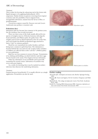 ABC of Dermatology
108
Treatment
This is either by freezing the advancing end of the lesion with
liquid nitrogen or by applying thiabendazole (10%)
suspension. Similar lesions in patients returning from tropical
countries raise the possibility of larva migrans from
strongyloides infestation, myiasis from the larvae of flies, or
gnathostomiasis.
Visceral larva migrans caused by Toxocara canis and Ascaris
lumbricoides may produce a transient rash.
Pediculosts (lice)
Infestation with lice became less common in the postwar years,
but the incidence has recently increased.
There are three areas of the body usually affected by two
species of wingless insects—Pediculus humanus, infecting the
head and body, and Phthirus pubis, the pubic louse. The
wingless insects feed on blood aspirated at the site of the bite,
and each female lays 60–80 encapsulated eggs attached to
hairs—”nits” in common parlance.
Head lice are transmitted via combs, brushes, and hats,
being more common in girls than boys. The infestation is
heaviest behind the ears and over the occiput. If the eyelashes
of children are affected this is with “crab lice” (Phthlrus pubis);
it is not pediculosis.
Body lice are less common in western Europe. Transmission
is by clothing and bedding, on which both lice and their eggs
may be found in the seams. Poor hygiene favours infestation.
Pubic lice infestation occurs worldwide and is generally
transmitted by sexual contact. Infestation of eyelashes may
occur with poor hygiene.
As a result of scratching there may be marked secondary
infection that obscures the underlying infestation.
Treatment
Gamma benzene hexachloride 1% is usually effective as a single
application. Permethrin can also be used.
Further reading
Alexander JO. Arthropods and human skin. Berlin: Springer-Verlag,
1984
Busvine JR. Insects and hygiene, 3rd ed. London: Chapman and Hall,
1980
Marshall AG. The ecology of ectoparasitic insects. New York: Academic
Press, 1981
Parish CL, Nutting WB, Schwartzman RM. Cutaneous infestation of
man and animal. New York: Greenwood, 1983
Pediculosis capitis
Head lice and nits
Phthirus pubis on eyelashes
 