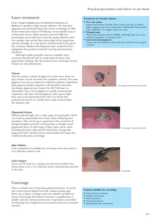 Practical procedures and where to use them
117
Laser treatment
Laser—Light Amplification by Stimulated Emission of
Radiation—produces high energy radiation. The first laser
apparatus was developed from microwave technology in 1960
by the nobel prize winner TH Mamian. It was initially used as
a destructive tool to ablate tumours, but now different
wavelengths can be directed at specific targets. Blood vessels,
for example, take up the blue/green light of the argon laser
and the red light of a ruby laser is well absorbed by the green
dye of tattoos. Modern developments have resulted in laser
equipment that produces minimal scarring and maximum
specificity.
Although smaller portable units are available, laser
treatment should still only be undertaken by those with
appropriate training. The skin lesions most commonly treated
by laser are described below.
Tattoos
Tattoos contain a variety of pigments so that more than one
type of laser may be necessary for complete removal. The same
pigment may vary in response in different patients. Superficial
dark pigment usually responds to the Q switch ruby laser,
but deeper pigment may require the Nd:YAG laser or
Alexandrite laser. Green pigment is usually removed with
a Q switch ruby laser and red pigment with a green light
laser such as the Q switched Nd:YAG. It is found that
professional tattoos are usually more easily removed than
the amateur type.
Pigmented lesions
Melanin absorbs light over a wide range of wavelengths, which
can result in undesirable loss of skin colour following laser
treatment. This can be put to good use in the treatment of
benign lentigines and café au lait patches or deeply seated
pigmented naevi. A wide range of laser types can be used,
including Q switch ruby and Nd:YAG lasers. Congenital
pigmented naevi should not be treated unless the biopsy has
confirmed that they are benign.
Hair follicles
Laser equipment is available for removing excess hair and is a
very effective cosmetic tool.
Laser surgery
Lasers can be used as a cutting tool and recent studies have
shown them to be a very effective means of producing incisions
in the skin.
Curettage
This is a simple way of removing epidermal lesions. A curette
has a metal spoon shaped end with a sharp cutting edge.
There are a variety of shapes and sizes suitable for different
lesions, from large seborrhoeic keratoses or papillomata to
smaller ones for minute keratin cysts. A specimen is provided
for histology but completeness of removal cannot be accurately
assessed.
Treatment of vascular lesions
• Port wine stains
Argon and carbon dioxide lasers cause scarring, so yellow
light emitting types such as Krypton, Flashlamp Powered Dye
Laser (FIPDL), or Copper Laser are used
• Telangiectasia
This is also treated with the FIPDL, although this can cause
transient purpura, or Copper Laser
• Cavernous haemangioma
These can be treated by yellow dye laser followed by surgical
excision
Curettage—seborrhoeic keratosis
Curettage—actinic keratosis
Curettage
Lesions suitable for curetting
• Seborrhoeic keratoses
• Solitary viral warts
• Solar keratoses
• Cutaneous horns
• Small basal cell carcinomas
 