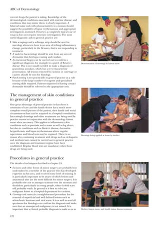 current drugs the patient is taking. Knowledge of the
dermatological conditions associated with systemic disease, and
conditions that may mimic them, is clearly important. A
bilateral malar rash with photosensitivity in a woman should
suggest the possibility of lupus erythematosus and appropriate
investigations instituted. However, a completely typical case of
rosacea does not require extensive investigation. The most
useful diagnostic aids in general practice are:
• Skin scrapings and a sellotape strip should be sent for
mycology whenever there is an area of itching inflammatory
change, particularly in the flexures, that is not responding to
treatment.
• A swab for bacteriology should be sent from any area of
dermatitis that develops crusting and exudate.
• An incisional biopsy can be carried out to confirm a
significant diagnosis, for example in a patch of Bowen’s
disease This is not usually needed to make a diagnosis of
granuloma annulare, which has a very characteristic
presentation. All lesions removed by excision or curettage or
cautery should be sent for histology.
• Patch testing is not practicable in general practice as a rule
because of the large number of reagents and specialised
nursing skills required. Patients suspected of having contact
dermatitis should be referred to the appropriate unit.
The management of skin conditions
in general practice
One great advantage of general practice is that there is
continuity of care and the family doctor has a much more
complete overall picture of the patient, their family and social
circumstances than can be acquired in a hospital consultation.
Increasingly dressings and other treatments are being used by
practice nurses in conjunction with the dermatology liaison
nurse when necessary. This applies to inflammatory skin
conditions such as psoriasis and eczema as well as leg ulcers,
but also to conditions such as Darier’s disease, dermatitis
herpetiformis, and lupus erythematosus where regular
supervision and blood tests may be required. There is no
reason why continuing treatment with drugs such as ciclosporin
and methotrexate cannot be carried out in general practice
once the diagnosis and treatment regime have been
established. Regular blood tests are mandatory when these
drugs are being used.
Procedures in general practice
The details of techniques decribed in chapter 24.
• Excisions and other forms of minor surgery are probably best
undertaken by a member of the practice who has developed
expertise in this area, and received some level of training. It
is particularly important to be aware of which lesions and
anatomical sites are the most difficult for minor surgery. It is
probably wise not to attempt excisions over the sternum and
shoulders, particularly in young people, where keloid scars
will probably result. In general it is best to refer any
malignant lesion to a hospital department for excision.
• Curettage and cautery is a straightforward procedure for the
removal of superficial and well defined lesions such as
seborrhoeic keratoses and viral warts. It is as well to send all
specimens for histology—to confirm the diagnosis and make
sure that an unsuspected malignancy is not missed. It is
important that a clinical probable diagnosis is made so as to
ABC of Dermatology
122
Dressings being applied at home by mother
Mother, liaison nurse, and health visitor discuss treatment
Demonstration of dressings by liaison nurse
 