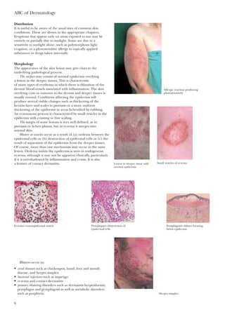 Distribution
It is useful to be aware of the usual sites of common skin
conditions. These are shown in the appropriate chapters.
Eruptions that appear only on areas exposed to sun may be
entirely or partially due to sunlight. Some are due to a
sensitivity to sunlight alone, such as polymorphous light
eruption, or a photosensitive allergy to topically applied
substances or drugs taken internally.
Morphology
The appearance of the skin lesion may give clues to the
underlying pathological process.
The surface may consist of normal epidermis overlying
a lesion in the deeper tissues. This is characteristic
of many types of erythema in which there is dilatation of the
dermal blood vessels associated with inflammation. The skin
overlying cysts or tumours in the dermis and deeper tissues is
usually normal. Conditions affecting the epidermis will
produce several visible changes such as thickening of the
keratin layer and scales in psoriasis or a more uniform
thickening of the epidermis in areas lichenified by rubbing.
An eczematous process is characterised by small vesicles in the
epidermis with crusting or fine scaling.
The margin of some lesions is very well defined, as in
psoriasis or lichen planus, but in eczema it merges into
normal skin.
Blisters or vesicles occur as a result of (a) oedema between the
epidermal cells or (b) destruction of epidermal cells or (c) the
result of separation of the epidermis from the deeper tissues.
Of course, more than one mechanism may occur in the same
lesion. Oedema within the epidermis is seen in endogenous
eczema, although it may not be apparent clinically, particularly
if it is overshadowed by inflammation and crusts. It is also
a feature of contact dermatitis.
ABC of Dermatology
6
Allergic reaction producing
photosensitivity
Lesion in deeper tissue with
normal epidermis
Small vesicles of eczema
Eczema—intraepidermal vesicle Pemphigus—destruction of
epidermal cells
Pemphigoid—blister forming
below epidermis
Blisters occur in:
• viral diseases such as chickenpox, hand, foot and mouth
disease, and herpes simplex
• bacterial infections such as impetigo
• eczema and contact dermatitis
• primary blistering disorders such as dermatitis herpetiformis,
pemphigus and pemphigoid as well as metabolic disorders
such as porphyria. Herpes simplex
 
