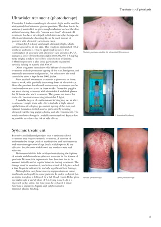 Ultraviolet treatment (phototherapy)
Ultraviolet B is short wavelength ultraviolet light and is used for
widespread thin lesions or guttate psoriasis. The dose has to be
accurately controlled to give enough radiation to clear the skin
without burning. Recently, “narrow waveband” ultraviolet B
treatment has been developed, which increases the therapeutic
effect and diminishes burning. It can be used instead of
psoralen with ultraviolet A in many cases.
Ultraviolet A is long wavelength ultraviolet light, which
activates psoralens in the skin. This results in diminished DNA
synthesis and hence reduced epidermal turnover. The
combination of psoralen with ultraviolet A is known as PUVA
therapy: a dose of 8-methoxypsoralen (8MOP), 0·6–0·8mg/kg
body weight, is taken one to two hours before treatment.
5-Methoxypsoralen is also used, particularly in patients
develop itching or nausea with 8MOP.
Other long term cumulative side effects of ultraviolet
treatment include premature ageing of the skin, lentigenes, and
eventually cutaneous malignancies. For this reason the total
cumulative dose is kept below 1000 Joules.
After medical assessment treatment is given two or three
times a week, with gradually increasing doses of ultraviolet A.
Once the psoriasis has cleared maintenance treatments can be
continued once every two or three weeks. Protective goggles
are worn during treatment with ultraviolet A and dark glasses
for 24 hours after each treatment. The glasses are tested for
their effectiveness in screening ultraviolet A light.
A variable degree of erythema and itching may occur after
treatment. Longer term side effects include a slight risk of
epitheliomas developing, premature ageing of the skin, and
cataract formation (which can be prevented by wearing
ultraviolet A filtering goggles during and after treatment). The
total cumulative dosage is carefully monitored and kept as low
as possible to reduce the risk of side effects.
Systemic treatment
Extensive and inflamed psoriasis that is resistant to local
treatment may require systemic treatment. A number of
antimetabolite drugs (such as azathioprine and hydroxyurea)
and immunosuppressive drugs (such as ciclosporin A) are
effective, but the most widely used are methotrexate and
acitretin.
Methotrexate inhibits folic acid synthesis during the S phase
of mitosis and diminishes epidermal turnover in the lesions of
psoriasis. Because it is hepatotoxic liver function has to be
assessed initially and at regular intervals during treatment. The
dosage must be monitored, and when a total of 1·5g is reached
a liver biopsy is indicated to exclude significant liver damage.
Although it is rare, bone marrow suppression can occur
insidiously and rapidly in some patients. In order to detect this
an initial test dose is followed by a full blood count. If this gives
normal results a weekly dose of 7·5–15mg is used. As it is
excreted in the urine, the dose must be reduced if renal
function is impaired. Aspirin and sulphonamides
diminish plasma binding.
Treatment of psoriasis
15
Guttate psoriasis suitable for ultraviolet B treatment
Ultraviolet B cabinet
Before phototherapy After phototherapy
 