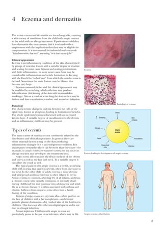 The terms eczema and dermatitis are interchangeable, covering
a wide variety of conditions from the child with atopic eczema
to the adult with an allergy to cement. If patients are told they
have dermatitis they may assume that it is related to their
employment with the implication that they may be eligible for
compensation. It is not unusual for industrial workers to ask
“Is it dermatitis, doctor?”, meaning “is it due to my job?”
Clinical appearance
Eczema is an inflammatory condition of the skin characterised
by groups of vesicular lesions with a variable degree of exudate
and scaling. In some cases dryness and scaling predominate,
with little inflammation. In more acute cases there may be
considerable inflammation and vesicle formation, in keeping
with the Greek for “to boil out”, from which the word eczema is
derived. Sometimes the main feature may be blisters that
become very large.
Eczema commonly itches and the clinical appearance may
be modified by scratching, which with time may produce
lichenification (thickening of the skin with increased skin
markings). Also as a result of scratching the skin surface may be
broken and have excoriations, exudate, and secondary infection.
Pathology
The characteristic change is oedema between the cells of the
epidermis, known as spongiosus, leading to formation of vesicles.
The whole epidermis becomes thickened with an increased
keratin layer. A variable degree of vasodilatation in the dermis
and an inflammatory infiltrate may be present.
Types of eczema
The many causes of eczema are not consistently related to the
distribution and clinical appearance. In general there are
either external factors acting on the skin producing
inflammatory changes or it is an endogenous condition. It is
important to remember there can be more than one cause—for
example, in atopic eczema or varicose eczema on the ankle an
allergic reaction may develop to the treatments used.
Atopic eczema affects mainly the flexor surfaces of the elbows
and knees as well as the face and neck. To a variable degree it
can affect the trunk as well.
The typical patient with atopic eczema is a fretful, scratching
child with eczema that varies in severity, often from one hour to
the next. In the older child or adult, eczema is more chronic
and widespread and its occurrence is often related to stress.
Atopic eczema is common, affecting 3% of all infants, and runs
a chronic course with variable remissions. It normally clears
during childhood but may continue into adolescence and adult
life as a chronic disease. It is often associated with asthma and
rhinitis. Sufferers from atopic eczema often have a family
history of the condition.
Variants of atopic eczema are pityriasis alba—white patches on
the face of children with a fair complexion—and chronic
juvenile plantar dermatosis—dry cracked skin of the forefoot in
children. This does not affect the interdigital spaces and is not
due to a fungal infection.
Eczema herpeticum. Children with atopic eczema are
particularly prone to herpes virus infection, which may be life
17
4 Eczema and dermatitis
Eczema
Pathology of eczema
Stress
Atopic
eczema
Skin
irritation
Inoculations
Infection
Foods
Climate
Sweating
House dust
mite
Factors leading to development of atopic eczema
Atopic eczema—distribution
 