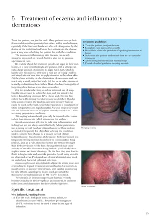 25
Treat the patient, not just the rash. Many patients accept their
skin condition with equanimity but others suffer much distress,
especially if the face and hands are affected. Acceptance by the
doctor of the individual and his or her attitudes to the disease
goes a long way to helping the patient live with the condition.
The common inflammatory skin diseases can nearly
always be improved or cleared, but it is wise not to promise
a permanent cure.
Be realistic about the treatment people can apply in their own
homes. It is easy to unthinkingly give patients with a widespread
rash a large amount of ointment to apply twice daily, which is
hardly used because: (a) they have a busy job or young children
and simply do not have time to apply ointment to the whole skin;
(b) they have arthritic or other limitations of movement and can
reach only a small part of the body; (c) the tar or other ointment
is smelly or discolours their clothes. Most of us have been guilty of
forgetting these factors at one time or another.
Dry skin tends to be itchy, so advise minimal use of soap.
Emollients are used to soften the skin, and the simpler the
better. Emulsifying ointment BP is cheap and effective but
rather thick. By mixing two tablespoons in a kitchen blender
with a pint of water, the result is a creamy mixture that can
easily be used in the bath. A useful preparation is equal parts of
white soft paraffin and liquid paraffin. Various proprietary bath
oils are available and can be applied directly to wet skin. There
are many proprietary emollients.
Wet weeping lesions should generally be treated with creams
rather than ointments (which remain on the surface).
Steroid ointments are effective in relieving inflammation and
itching but are not always used effectively. Advise patients to
use a strong steroid (such as betamethasone or fluocinolone
acetonide) frequently for a few days to bring the condition
under control; then change to a weaker steroid (dilute
betamethasone, fluocinolone, clobetasone, hydrocortisone) less
frequently. Strong steroids should not be continued for long
periods, and, as a rule, do not prescribe any steroid stronger
than hydrocortisone for the face. Strong steroids can cause
atrophy of the skin if used for long periods, particularly when
applied under occlusive dressings. On the face they may lead to
florid telangiectasia and acne-like pustules. Avoid using steroids
on ulcerated areas. Prolonged use of topical steroids may mask
an underlying bacterial or fungal infection.
Immunosuppressants are a valuable adjunct in severe cases not
responding to topical treatment and antibiotics. Ciclosporin is
usually given on an intermittent basis, with careful monitoring
for side effects. Azathioprine is also used, provided the
thiopurine methyl transferase (TPMT) level is normal.
Tacrolimus is an immunosuppressant that has recently
become available in two strengths as an ointment. It promises
to be a successful treatment but is relatively expensive.
Specific treatment
Wet, inflamed, exuding lesions
(1) Use wet soaks with plain water, normal saline, or
aluminium acetate (0·6%). Potassium permanganate
(0·1%) solution should be used if there is any sign of
infection.
5 Treatment of eczema and inflammatory
dermatoses
Treatment guidelines
• Treat the patient, not just the rash
• Complete cure may not be possible
• Be realistic about the problems of applying treatments at
home
• Make sure the patient understands how to carry out the
treatment
• Advise using emollients and minimal soap
• Provide detailed guidance on using steroids
Weeping eczema
Acute erythema
 