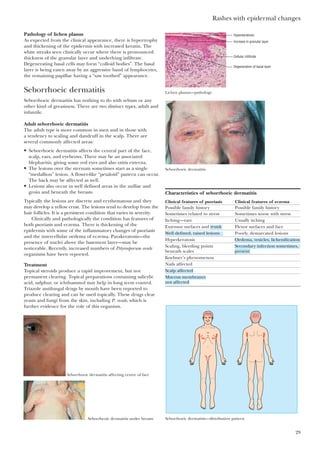 Rashes with epidermal changes
29
Pathology of lichen planus
As expected from the clinical appearance, there is hypertrophy
and thickening of the epidermis with increased keratin. The
white streaks seen clinically occur where there is pronounced
thickness of the granular layer and underlying infiltrate.
Degenerating basal cells may form “colloid bodies”. The basal
layer is being eaten away by an aggressive band of lymphocytes,
the remaining papillae having a “saw toothed” appearance.
Seborrhoeic dermatitis
Seborrhoeic dermatitis has nothing to do with sebum or any
other kind of greasiness. There are two distinct types, adult and
infantile.
Adult seborrhoeic dermatitis
The adult type is more common in men and in those with
a tendency to scaling and dandruff in the scalp. There are
several commonly affected areas:
• Seborrhoeic dermatitis affects the central part of the face,
scalp, ears, and eyebrows. There may be an associated
blepharitis, giving some red eyes and also otitis externa.
• The lesions over the sternum sometimes start as a single
“medallion” lesion. A flower-like “petaloid” pattern can occur.
The back may be affected as well.
• Lesions also occur in well defined areas in the axillae and
groin and beneath the breasts.
Typically the lesions are discrete and erythematous and they
may develop a yellow crust. The lesions tend to develop from the
hair follicles. It is a persistent condition that varies in severity.
Clinically and pathologically the condition has features of
both psoriasis and eczema. There is thickening of the
epidermis with some of the inflammatory changes of psoriasis
and the intercellular oedema of eczema. Parakeratosis—the
presence of nuclei above the basement layer—may be
noticeable. Recently, increased numbers of Pityrosporum ovale
organisms have been reported.
Treatment
Topical steroids produce a rapid improvement, but not
permanent clearing. Topical preparations containing salicylic
acid, sulphur, or ichthammol may help in long term control.
Triazole antifungal drugs by mouth have been reported to
produce clearing and can be used topically. These drugs clear
yeasts and fungi from the skin, including P. ovale, which is
further evidence for the role of this organism.
Hyperkeratosis
Increase in granular layer
Cellular infiltrate
Degeneration of basal layer
Lichen planus—pathology
Seborrhoeic dermatitis
Seborrhoeic dermatitis—distribution pattern
Seborrhoeic dermatitis affecting centre of face
Seborrheoic dermatitis under breasts
Characteristics of seborrhoeic dermatitis
Clinical features of psoriasis Clinical features of eczema
Possible family history Possible family history
Sometimes related to stress Sometimes worse with stress
Itching—rare Usually itching
Extensor surfaces and Flexor surfaces and face
Poorly, demarcated lesions
Hyperkeratosis
Scaling, bleeding points
beneath scales
Koebner’s phenomenon
Nails affected
trunk
Well defined, raised lesions
Oedema, vesicles, lichenification
Scalp affected
not affected
Mucous membranes
Secondary infection sometimes,
present
 