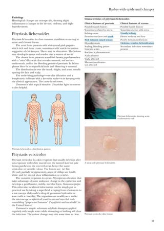 Rashes with epidermal changes
31
Pathology
Histological changes are non-specific, showing slight
inflammatory changes in the dermis, oedema, and slight
hyperkeratosis.
Pityriasis lichenoides
Pityriasis lichenoides is a less common condition occurring in
acute and chronic forms.
The acute form presents with widespread pink papules
which itch and form crusts, sometimes with vesicle formation
suggestive of chickenpox. There may be ulceration. The lesions
may develop in crops and resolve over a matter of weeks.
The chronic form presents as reddish brown papules—often
with a “mica”-like scale that reveals a smooth, red surface
underneath, unlike the bleeding points of psoriasis. In lichen
planus there is no superficial scale and blistering is unusual.
The distribution is over the trunk, thighs, and arms, usually
sparing the face and scalp.
The underlying pathology—vascular dilatation and a
lymphocytic infiltrate with a keratotic scale—is in keeping with
the clinical appearance. The cause is unknown.
Treatment is with topical steroids. Ultraviolet light treatment
is also helpful.
Characteristics of pityriasis lichenoides
Clinical features of psoriasis Clinical features of eczema
Possible family history Possible family history
Sometimes related to stress Sometimes worse with stress
Itching—rare
Extensor surfaces and Flexor surfaces and face
Poorly demarcated lesions
Hyperkeratosis
Scaling, bleeding points Secondary infection sometimes
beneath scales present
Koebner’s phenomenon
Nails affected
Scalp affected
Mucous membranes
not affected
Pityriasis lichenoides showing acute
erythematous rash
A mica scale pityriasis lichenoides
Pityriasis versicolor skin lesions
Pityriasis lichenoides—distribution pattern
Pityriasis versicolor
Pityriasis versicolor is a skin eruption that usually develops after
sun exposure with white macules on the tanned skin but pale
brown patches on the covered areas, hence the name
versicolor, or variable colour. The lesions are: (a) flat;
(b) only partially depigmented—areas of vitiligo are totally
white; and (c) do not show inflammation or vesicles.
The causative organism is a yeast, Pityrosporum orbiculare, that
takes advantage of some unknown change in the epidermis and
develops a proliferative, stubby, mycelial form, Malassezia furfur.
This otherwise incidental information can be simply put to
practical use by taking a superficial scraping from a lesion on to
a microscope slide—add a drop of potassium hydroxide or
water with a coverslip. The organisms are readily seen under
the microscope as spherical yeast forms and mycelial rods,
resembling “grapes and bananas” (“spaghetti and meatballs” in
the United States).
Treatment is simple: selenium sulphide shampoo applied
regularly with ample water while showering or bathing will clear
the infection. The colour change may take some time to clear.
Usually itching
Well defined, raised lesions
Oedema, vesicles, lichenification
trunk
 