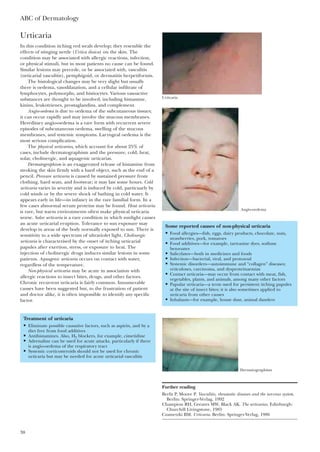 Urticaria
In this condition itching red weals develop; they resemble the
effects of stinging nettle (Urtica dioica) on the skin. The
condition may be associated with allergic reactions, infection,
or physical stimuli, but in most patients no cause can be found.
Similar lesions may precede, or be associated with, vasculitis
(urticarial vasculitis), pemphigoid, or dermatitis herpetiformis.
The histological changes may be very slight but usually
there is oedema, vasodilatation, and a cellular infiltrate of
lymphocytes, polymorphs, and histiocytes. Various vasoactive
substances are thought to be involved, including histamine,
kinins, leukotrienes, prostaglandins, and complement.
Angio-oedema is due to oedema of the subcutaneous tissues;
it can occur rapidly and may involve the mucous membranes.
Hereditary angio-oedema is a rare form with recurrent severe
episodes of subcutaneous oedema, swelling of the mucous
membranes, and systemic symptoms. Laryngeal oedema is the
most serious complication.
The physical urticarias, which account for about 25% of
cases, include dermatographism and the pressure, cold, heat,
solar, cholinergic, and aquagenic urticarias.
Dermatographism is an exaggerated release of histamine from
stroking the skin firmly with a hard object, such as the end of a
pencil. Pressure urticaria is caused by sustained pressure from
clothing, hard seats, and footwear; it may last some hours. Cold
urticaria varies in severity and is induced by cold, particuarly by
cold winds or by the severe shock of bathing in cold water. It
appears early in life—in infancy in the rare familial form. In a
few cases abnormal serum proteins may be found. Heat urticaria
is rare, but warm environments often make physical urticaria
worse. Solar urticaria is a rare condition in which sunlight causes
an acute urticarial eruption. Tolerance to sun exposure may
develop in areas of the body normally exposed to sun. There is
sensitivity to a wide spectrum of ultraviolet light. Cholinergic
urticaria is characterised by the onset of itching urticarial
papules after exertion, stress, or exposure to heat. The
injection of cholinergic drugs induces similar lesions in some
patients. Aquagenic urticaria occurs on contact with water,
regardless of the temperature.
Non-physical urticaria may be acute in association with
allergic reactions to insect bites, drugs, and other factors.
Chronic recurrent urticaria is fairly common. Innumerable
causes have been suggested but, to the frustration of patient
and doctor alike, it is often impossible to identify any specific
factor.
ABC of Dermatology
38
Urticaria
Some reported causes of non-physical urticaria
• Food allergies—fish, eggs, dairy products, chocolate, nuts,
strawberries, pork, tomatoes
• Food additives—for example, tartrazine dyes, sodium
benzoates
• Salicylates—both in medicines and foods
• Infection—bacterial, viral, and protozoal
• Systemic disorders—autoimmune and “collagen” diseases;
reticuloses, carcinoma, and dysproteinaemias
• Contact urticaria—may occur from contact with meat, fish,
vegetables, plants, and animals, among many other factors
• Papular urticaria—a term used for persistent itching papules
at the site of insect bites; it is also sometimes applied to
urticaria from other causes
• Inhalants—for example, house dust, animal danders
Treatment of urticaria
• Eliminate possible causative factors, such as aspirin, and by a
diet free from food additives
• Antihistamines. Also, H2 blockers, for example, cimetidine
• Adrenaline can be used for acute attacks, particularly if there
is angio-oedema of the respiratory tract
• Systemic corticosteroids should not be used for chronic
urticaria but may be needed for acute urticarial vasculitis
Angio-oedema
Dermatographism
Further reading
Berlit P, Moore P. Vasculitis, rheumatic diseases and the nervous system.
Berlin: Springer-Verlag, 1992
Champion RH, Greaves MW, Black AK. The urticarias. Edinburgh:
Churchill Livingstone, 1985
Czametzki BM. Urticaria. Berlin: Springer-Verlag, 1986
 