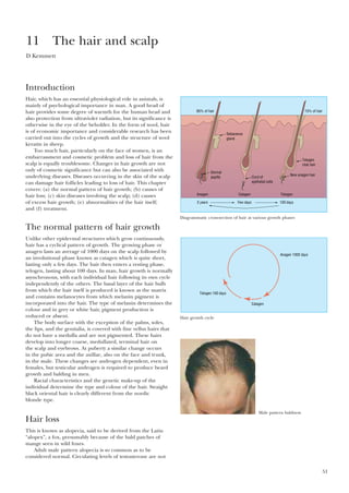 51
Introduction
Hair, which has an essential physiological role in animals, is
mainly of psychological importance in man. A good head of
hair provides some degree of warmth for the human head and
also protection from ultraviolet radiation, but its significance is
otherwise in the eye of the beholder. In the form of wool, hair
is of economic importance and considerable research has been
carried out into the cycles of growth and the structure of wool
keratin in sheep.
Too much hair, particularly on the face of women, is an
embarrassment and cosmetic problem and loss of hair from the
scalp is equally troublesome. Changes in hair growth are not
only of cosmetic significance but can also be associated with
underlying diseases. Diseases occurring in the skin of the scalp
can damage hair follicles leading to loss of hair. This chapter
covers: (a) the normal pattern of hair growth; (b) causes of
hair loss; (c) skin diseases involving the scalp; (d) causes
of excess hair growth; (e) abnormalities of the hair itself;
and (f) treatment.
The normal pattern of hair growth
Unlike other epidermal structures which grow continuously,
hair has a cyclical pattern of growth. The growing phase or
anagen lasts an average of 1000 days on the scalp followed by
an involutional phase known as catagen which is quite short,
lasting only a few days. The hair then enters a resting phase,
telogen, lasting about 100 days. In man, hair growth is normally
asynchronous, with each individual hair following its own cycle
independently of the others. The basal layer of the hair bulb
from which the hair itself is produced is known as the matrix
and contains melanocytes from which melanin pigment is
incorporated into the hair. The type of melanin determines the
colour and in grey or white hair, pigment production is
reduced or absent.
The body surface with the exception of the palms, soles,
the lips, and the genitalia, is covered with fine vellus hairs that
do not have a medulla and are not pigmented. These hairs
develop into longer coarse, medullated, terminal hair on
the scalp and eyebrows. At puberty a similar change occurs
in the pubic area and the axillae, also on the face and trunk,
in the male. These changes are androgen dependent, even in
females, but testicular androgen is required to produce beard
growth and balding in men.
Racial characteristics and the genetic make-up of the
individual determine the type and colour of the hair. Straight
black oriental hair is clearly different from the nordic
blonde type.
Hair loss
This is known as alopecia, said to be derived from the Latin
“alopex”, a fox, presumably because of the bald patches of
mange seen in wild foxes.
Adult male pattern alopecia is so common as to be
considered normal. Circulating levels of testosterone are not
11 The hair and scalp
D Kemmett
85% of hair 15% of hair
Sebaceous
gland
Dermal
papilla Cord of
epithelial cells
Anagen Catagen Telogen
3 years Few days 100 days
New anagen hair
Telogen
club hair
Diagrammatic cross-section of hair at various growth phases
Anagen 1000 days
Catagen
Telogen 100 days
Hair growth cycle
Male pattern baldness
 
