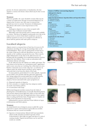 The hair and scalp
53
present. In chronic malnutrition or kwashiorkor, the hair
assumes a curious red/brown colour which may be due to iron
deficiency.
Treatment
Wherever possible, the cause should be treated. This may be
a matter of replacement therapy in hormonal deficiency. In
alopecia due to stress, once this cause is removed hair
growth may revert to normal. Treatment of inflammatory
skin disease will result in some improvement of the
hair loss.
Androgenic alopecia in men is best accepted, with
assurance that it indicates normal virility.
Minoxidil causes hair growth and is commercially available
as a lotion. This has to be applied continuously every day as the
scalp reverts to a level of loss which would have occurred
without treatment as soon as it is stopped. It is effective in
about half the patients with male pattern alopecia.
Localised alopecia
Alopecia areata is a common form of hair loss. It is seen in 2%
of patients attending the average dermatology clinic in the
United Kingdom. There may be small patches of hair loss or
the whole scalp may be affected. Resolution occurs in a few
months or the condition may persist for years. There may be
slight inflammation of the skin in the affected areas—in
keeping with the possibility of an underlying immune reaction
against the hair follicles. There is also an association with
autoimmue disease and atopy.
In the affected areas the follicles are visible and empty. The
hairs about to be lost have an “exclamation mark” appearance
and in some areas that are resolving, fine vellus hairs are seen.
Patches commonly occur on the scalp, face, or eyebrows. In
alopecia totalis, the whole head is involved, and in alopecia
universalis hair is lost from the whole of the body.
In many patients, particularly if it is a first episode, regrowth
occurs within a few months with fine pale hairs appearing
first, being replaced by normal adult hair. In older patients,
non-pigmented hair may persist in previous patches of
alopecia. Factors associated with a poor prognosis are:
(1) Repeated episodes of alopecia
(2) Very extensive or complete hair loss (alopecia totalis)
(3) Early onset before puberty
(4) In association with atopy
Differential diagnosis includes trauma from the habit of
plucking hair (trichotillomania) in mentally disturbed patients
and traction alopecia from tight hair rollers or hair styles that
involve tension on the hair. In fungal infections (tinea capitis)
there is scaling and broken hairs. Fungal spores or hyphae are
visible in hair specimens on microscopy.
Inflammation is present with loss of hair follicles in lupus
erythematosus and lichen planus.
Treatment
An initial limited area of alopecia areata in adult life can be
expected to regrow and treatment is generally not needed.
Treatments that are carried out include:
(1) Injection of triamcinolone diluted with local anaesthetic
which usually stimulates localised regrowth of hair.
Unfortunately it often falls out again and there is a risk of
causing atrophy. Topical steroid lotion can be used but
results are variable.
Causes of diffuse non-scarring alopecia
Androgenetic alopecia
• Male pattern
• Female pattern
Endocrine-thyroid disease (hypothyroidism and hyperthyroidism)
• Hypopituitarism
• Diabetes mellitus
Stress
• Postpartum
• Postoperative
• Postfebrile
Drugs
• Cytotoxics
• Anticoagulants anagen
• Antithyroid agents effluvium
• Ciclosporin
Erythrodermic skin disease
• Psoriasis
• Eczema
• Inflammatory
Deficiency states
• Protein malnutrition
• Iron deficiency
telogen
effluvium
Alopecia areata Alopecia areata, showing exclamation
mark hairs
Alopecia totalis
Trichotillomania Traction alopecia
 