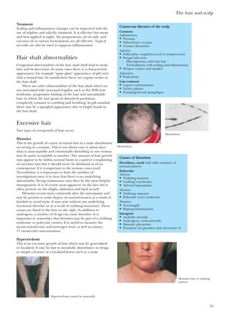 The hair and scalp
55
Treatment
Scaling and inflammatory changes can be improved with the
use of sulphur and salicylic ointment. It is effective but messy
and best applied at night. Tar preparations, oil of cade, and
coconut oil in various formulations are all effective. Topical
steroids can also be used to suppress inflammation.
Hair shaft abnormalities
Congenital abnormalities of the hair shaft itself lead to weak,
thin and broken hairs. In some cases there is a characteristic
appearance, for example “spun glass” appearance of pili torti
with a twisted hair. In monilethrix there are regular nodes in
the hair shaft.
There are other abnormalities of the hair shaft which are
not associated with increased fragility, such as the Willi hair
syndrome, progressive kinking of the hair and uncombable
hair, in which the hair grows in disorderly profusion,
completely resistant to combing and brushing. In pili annulati
there may be a spangled appearance due to bright bands in
the hair shaft.
Excessive hair
Two types of overgrowth of hair occur:
Hirsuties
This is the growth of coarse terminal hair in a male distribution
occurring in a woman. This is not always easy to assess since
what is unacceptable and emotionally disturbing to one woman
may be quite acceptable to another. The amount of hair growth
may appear to be within normal limits in a patient complaining
of excessive hair but it should never be dismissed as of no
consequence if it is important to the woman concerned.
Nevertheless, it is important to limit the number of
investigations once it is clear that there is no underlying
abnormality. Strong reassurance may then be the most helpful
management. It is of course most apparent on the face but is
often present on the thighs, abdomen and back as well.
Hirsuties occurs most commonly after the menopause and
may be present to some degree in normal women as a result of
familial or racial traits. It may arise without any underlying
hormonal disorder or as a result of virilising hormones. These
causes are listed in the box on the right. In addition to
androgens, a number of drugs can cause hirsuties. It is
important to remember that hirsuties may be part of a virilising
syndrome or polycystic ovaries. It is useful to measure the
serum testosterone and oestrogen level, as well as urinary
17 oxosteroid concentrations.
Hypertrichosis
This is an excessive growth of hair which may be generalised
or localised. It may be due to metabolic disturbance or drugs,
or simply a feature of a localised lesion such as a mole.
Causes of hirsutism
Hereditary, racial with wide variation of
normal pattern
Endocrine
Adrenal
• Virilising tumours
• Cushing’s syndrome
• Adrenal hyperplasia
Ovarian
• Virilising tumours
• Polycystic ovary syndrome
Pituitary
• Acromegaly
• Hyperprolactinaemia
Iatrogenic
• Anabolic steroids
• Androgens, corticosteroids
• Danazol, phenytoin
• Psoralens (in psoralen with ultraviolet A)
Cutaneous diseases of the scalp
Common
Inflammatory
• Psoriasis
• Seborrhoeic eczema
• Contact dermatitis
Infection
• Folliculitis—staphylococcal or streptococcal
• Fungal infection
Microsporum, with hair loss
Trichophyton, with scaling and inflammation
• Herpes—zoster and simplex
Infestation
• Pediculosis
Less common
• Lupus erythematosus
• Lichen planus
• Pemphigoid and pemphigus
Monilethrix
Monilethrix
Hirsuties due to virilising
tumour
Hypertrichosis caused by minoxidil
 