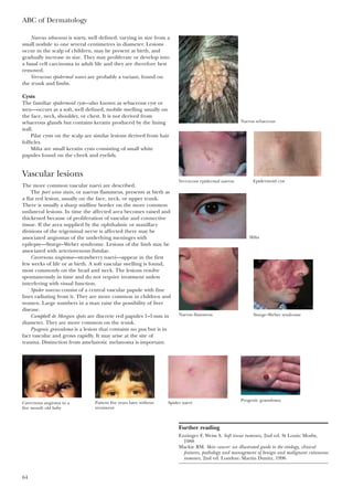 Naevus sebaceous is warty, well defined, varying in size from a
small nodule to one several centimetres in diameter. Lesions
occur in the scalp of children, may be present at birth, and
gradually increase in size. They may proliferate or develop into
a basal cell carcinoma in adult life and they are therefore best
removed.
Verrucous epidermal naevi are probably a variant, found on
the trunk and limbs.
Cysts
The familiar epidermoid cyst—also known as sebaceous cyst or
wen—occurs as a soft, well defined, mobile swelling usually on
the face, neck, shoulder, or chest. It is not derived from
sebaceous glands but contains keratin produced by the lining
wall.
Pilar cysts on the scalp are similar lesions derived from hair
follicles.
Milia are small keratin cysts consisting of small white
papules found on the cheek and eyelids.
Vascular lesions
The more common vascular naevi are described.
The port wine stain, or naevus flammeus, presents at birth as
a flat red lesion, usually on the face, neck, or upper trunk.
There is usually a sharp midline border on the more common
unilateral lesions. In time the affected area becomes raised and
thickened because of proliferation of vascular and connective
tissue. If the area supplied by the ophthalmic or maxillary
divisions of the trigeminal nerve is affected there may be
associated angiomas of the underlying meninges with
epilepsy—Sturge–Weber syndrome. Lesions of the limb may be
associated with arteriovenous fistulae.
Cavernous angioma—strawberry naevi—appear in the first
few weeks of life or at birth. A soft vascular swelling is found,
most commonly on the head and neck. The lesions resolve
spontaneously in time and do not require treatment unless
interfering with visual function.
Spider naevus consist of a central vascular papule with fine
lines radiating from it. They are more common in children and
women. Large numbers in a man raise the possibility of liver
disease.
Campbell de Morgan spots are discrete red papules 1–5 mm in
diameter. They are more common on the trunk.
Pyogenic granuloma is a lesion that contains no pus but is in
fact vascular and grows rapidly. It may arise at the site of
trauma. Distinction from amelanotic melanoma is important.
ABC of Dermatology
64
Further reading
Enzinger F, Weiss S. Soft tissue tumours, 2nd ed. St Louis: Mosby,
1988
Mackie RM. Skin cancer: an illustrated guide to the etiology, clinical
features, pathology and management of benign and malignant cutaneous
tumours, 2nd ed. London: Martin Dunitz, 1996
Naevus sebaceous
Verrucous epidermal naevus Epidermoid cyst
Milia
Naevus flammeus Sturge–Weber syndrome
Cavernous angioma in a
five month old baby
Patient five years later without
treatment
Spider naevi
Pyogenic granuloma
 